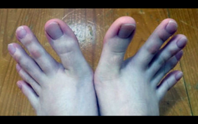 她發現自己穿露趾的鞋子時都會一直被看「PO出雙腳照」後網友驚呆：乾這食指太可怕！